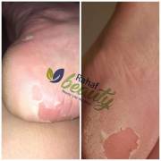  Foot scrub - Rahaf Beauty, fig. 4 